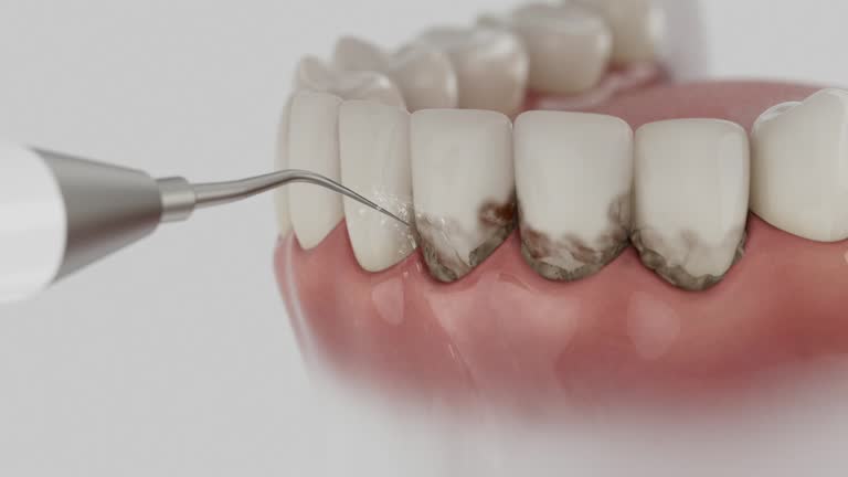 Reliable Wisdom Tooth Removal contractor in Carbon County County, WY by Dentist Open Now